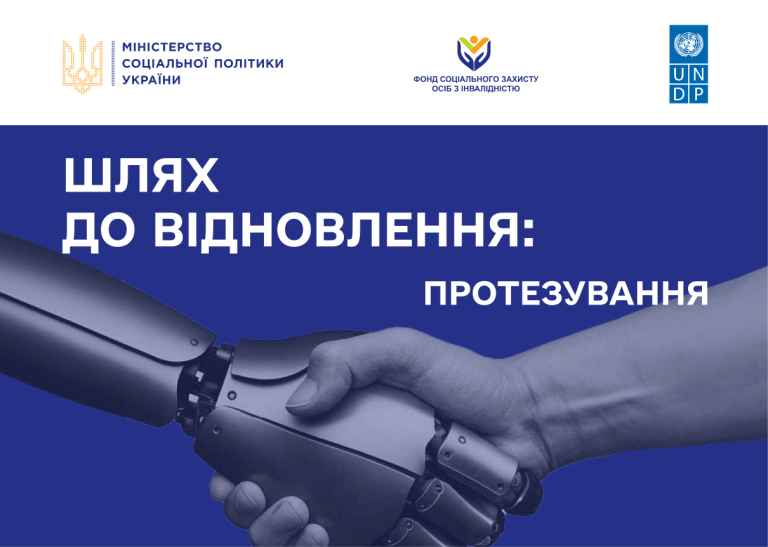 Шлях до відновлення: протезування осіб з ампутацією