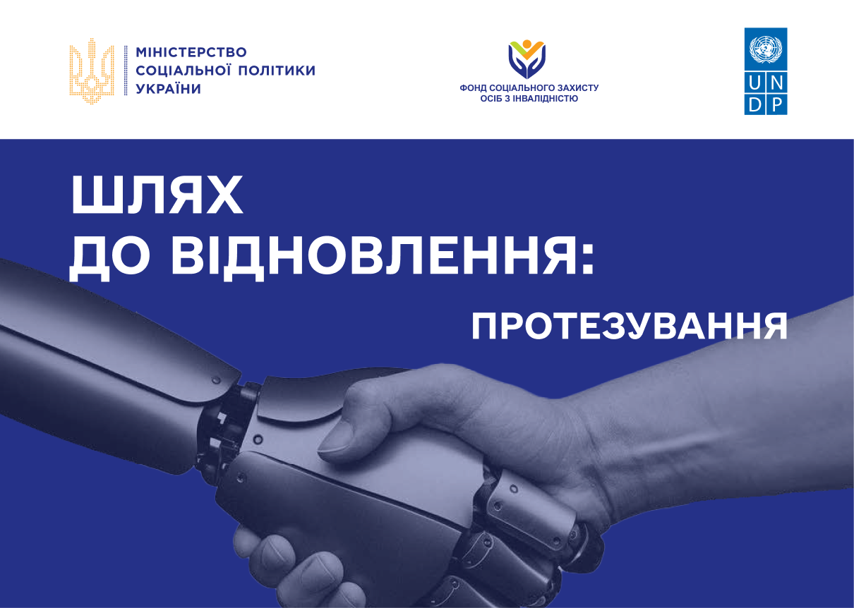 Шлях до відновлення: протезування осіб з ампутацією