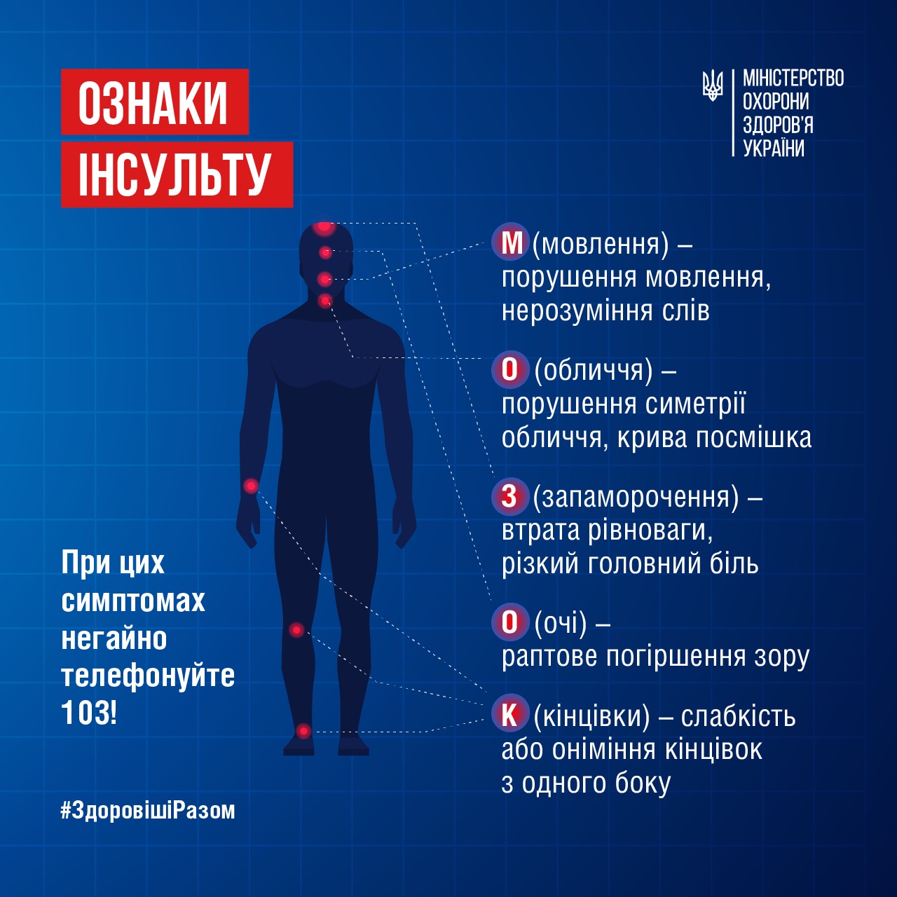Головне про інсульт